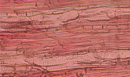 Identificación al microscopio del olmo (sección radial).
