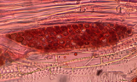 Identificación al microscopio del olmo (sección tangencial).