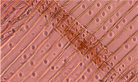 Identificación al microscopio del enebro (sección radial).